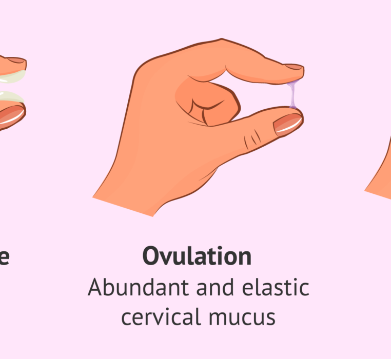 Vaginal discharge